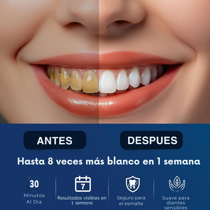 3D WHITE BLANQUEADOR DENTAL